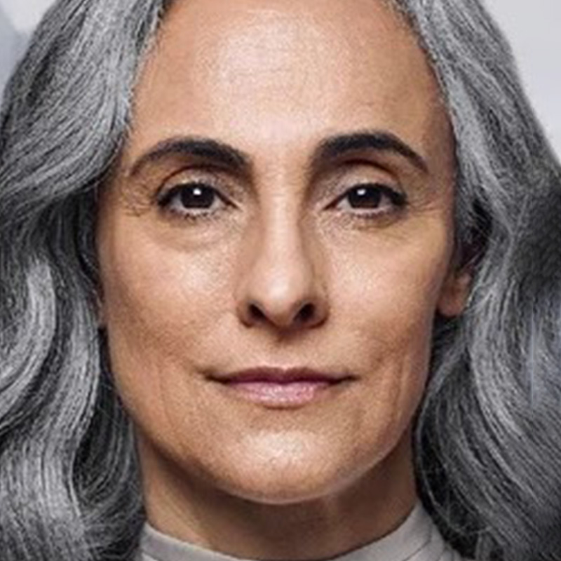 Same patient after treatment, front-facing portrait