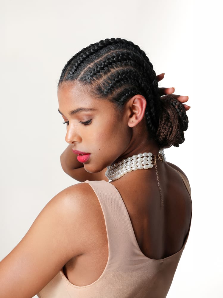 Microneedling